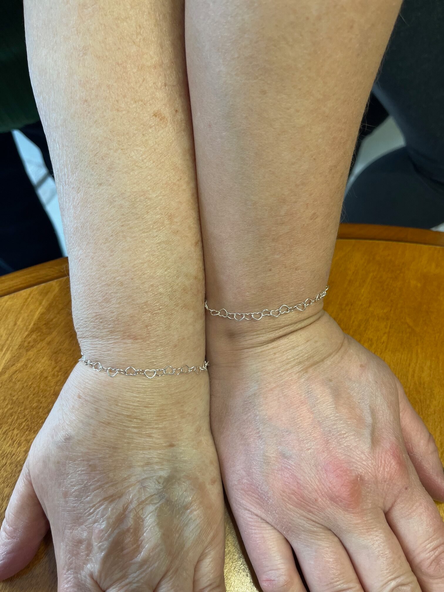 Two hands showing matching silver permanent bracelets